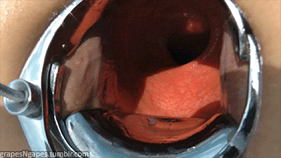 pFHXgdz02cded0b25d9f70f.gif